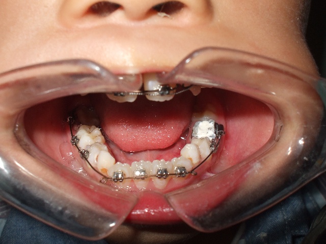 大力水手诞生90周年 大力水手叫什么名字菠菜什么梗“开云电竞”(图1) 开云电竞官网